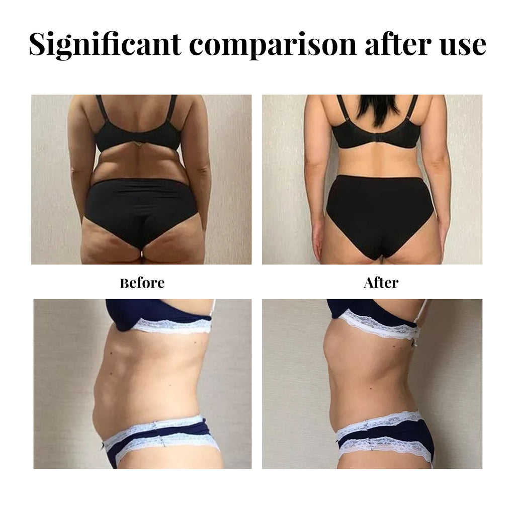 Belly Lift Tape, Lifts Loose Skin Tighten Shape Slim Belly Button Tape
